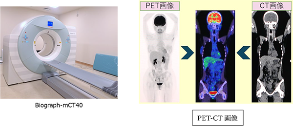 PET-CT